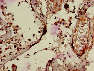 RNF126 Antibody (aa39-225)