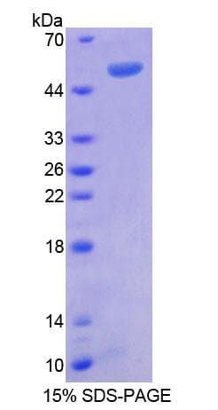 Human RGS1 Protein (Recombinant His-GST)