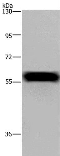 Polyclonal Rabbit anti-Human FGB / Fibrinogen Beta Chain Antibody (IHC, WB)