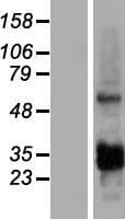 CCDC107 Protein (Over-Expression Lysate Myc-DDK (Flag))