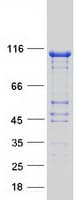 Human NRDE2 / C14orf102 Protein (Recombinant Myc-DDK (Flag))