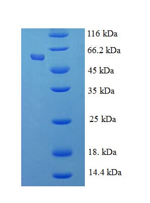 Human RBBP7 / RbAp46 Protein (Recombinant His-SUMO)