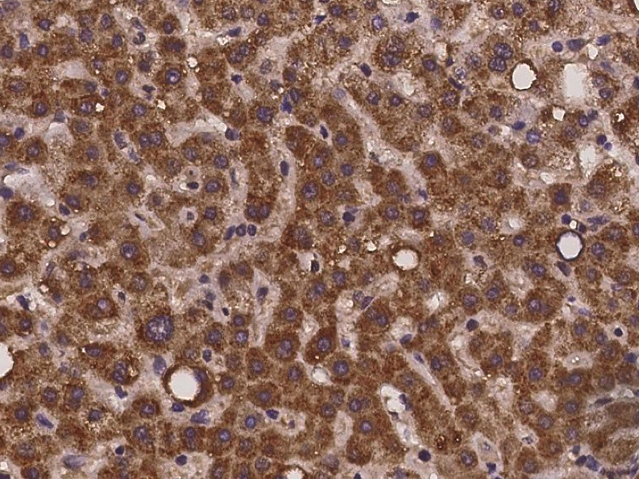 Polyclonal Rabbit anti-Human ZNF799 Antibody (IHC)