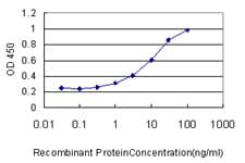 PathPlus™ MVP / VAULT1 Antibody (clone 2H3-1A6)