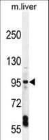 EXOC3L1 Antibody (aa652-680)