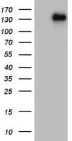 ZEB1 / AREB6 Antibody (aa1-350, clone OTI8A2)