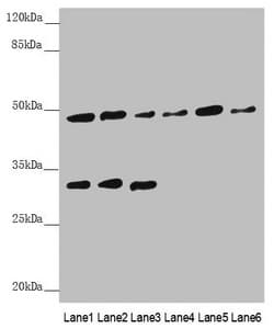 Polyclonal Rabbit anti-Human BCS1L Antibody (IHC, WB)