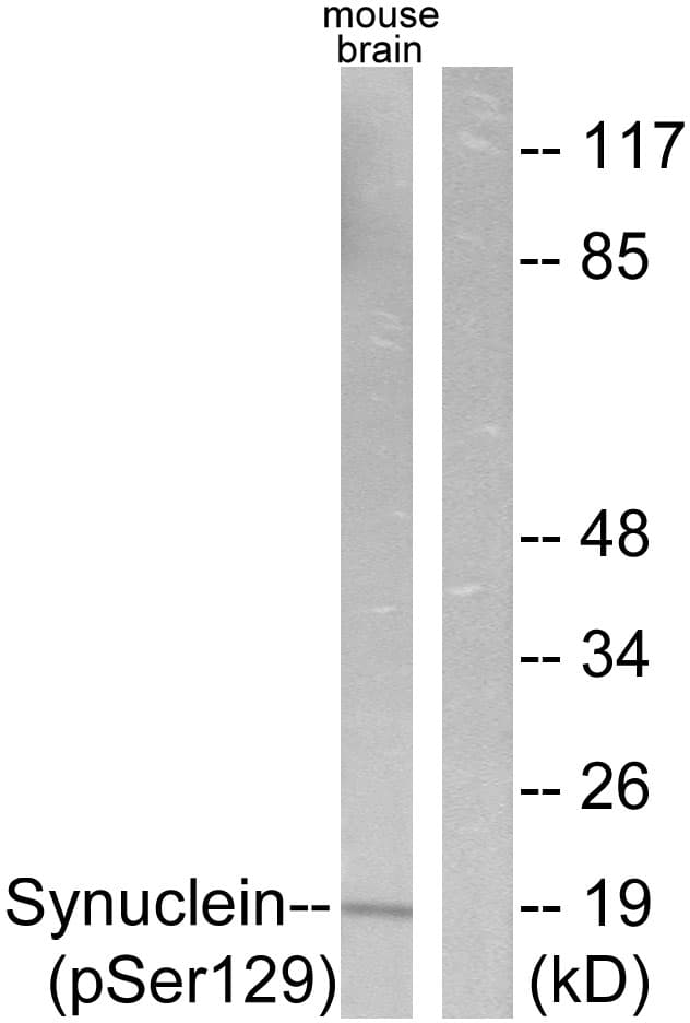 Polyclonal Rabbit anti-Human Synuclein Antibody (phospho-Ser129, IHC, WB)