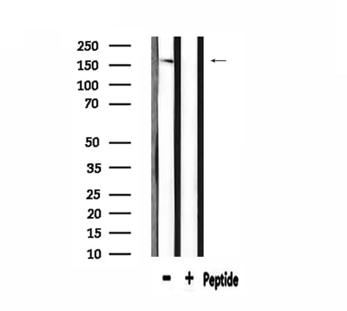ABCC2 / MRP2 Antibody