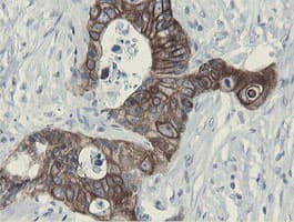 SLA2 / SLAP2 Antibody (clone OTI2G3)