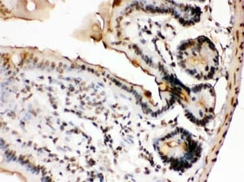 FOSB Antibody