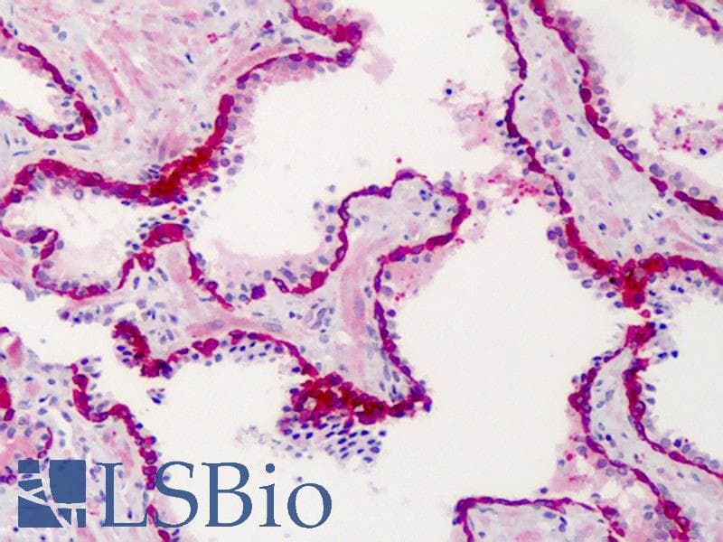 IHC-plus™ Polyclonal Rabbit anti-Human SLFN12 Antibody (IHC, WB)