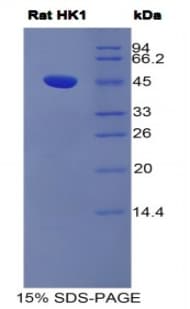 Rat HK1 / Hexokinase 1 Protein (Recombinant His)