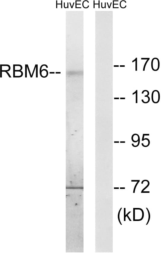 Polyclonal Rabbit anti-Human RBM6 / 3G2 Antibody (aa991-1040, IHC, IF, WB)
