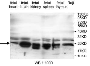 Polyclonal Rabbit anti-Human RAB14 Antibody (aa1-215, IHC, WB)