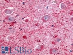 PathPlus™ Polyclonal Rabbit anti-Human NMUR2 Antibody (C-Terminus, IHC)