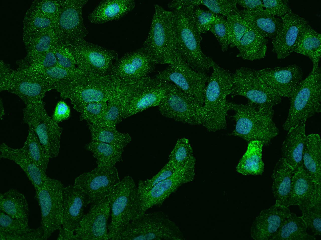 PPP1R18 Antibody