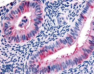 PathPlus™ Polyclonal Rabbit anti-Human RXFP2 / LGR8 Antibody (Extracellular Domain, IHC)