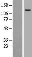 AP3B1 Protein (Over-Expression Lysate Myc-DDK (Flag))