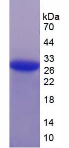 Human TGFBR1 / ALK5 Protein (Recombinant His-T7)