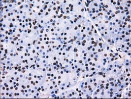 RPA2 / RFA2 / RPA34 Antibody (clone OTI7C12)