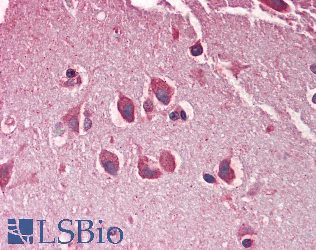 IHC-plus™ MXRA5 Antibody (aa1454-1467)