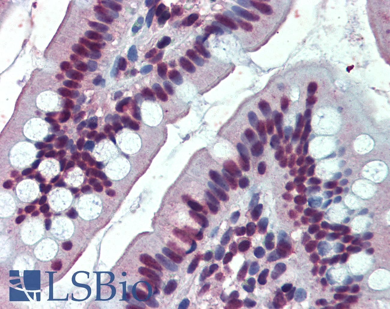 IHC-plus™ Polyclonal Goat anti-Human EWSR1 / EWS Antibody (aa201-215, IHC, WB)