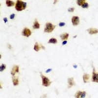 FMR1 / FMRP Antibody