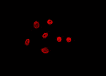 FUBP1 Antibody