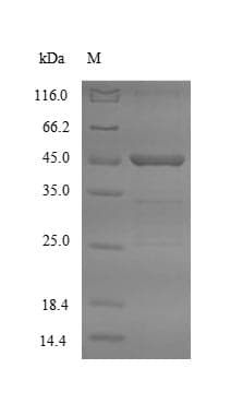 Mouse ASGR2 Protein (Recombinant 10His-SUMO, N-terminus + Myc, C-terminus)
