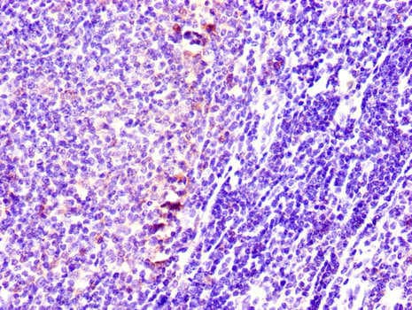 STMN1 / Stathmin / LAG Antibody