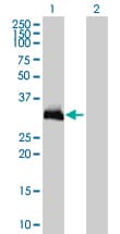 Monoclonal Mouse anti-Human HOXC9 Antibody (clone 2B12, WB)