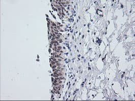 NKIRAS1 Antibody (clone OTI6C11)