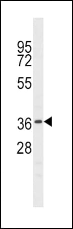 NKX6-1 Antibody (aa285-314)