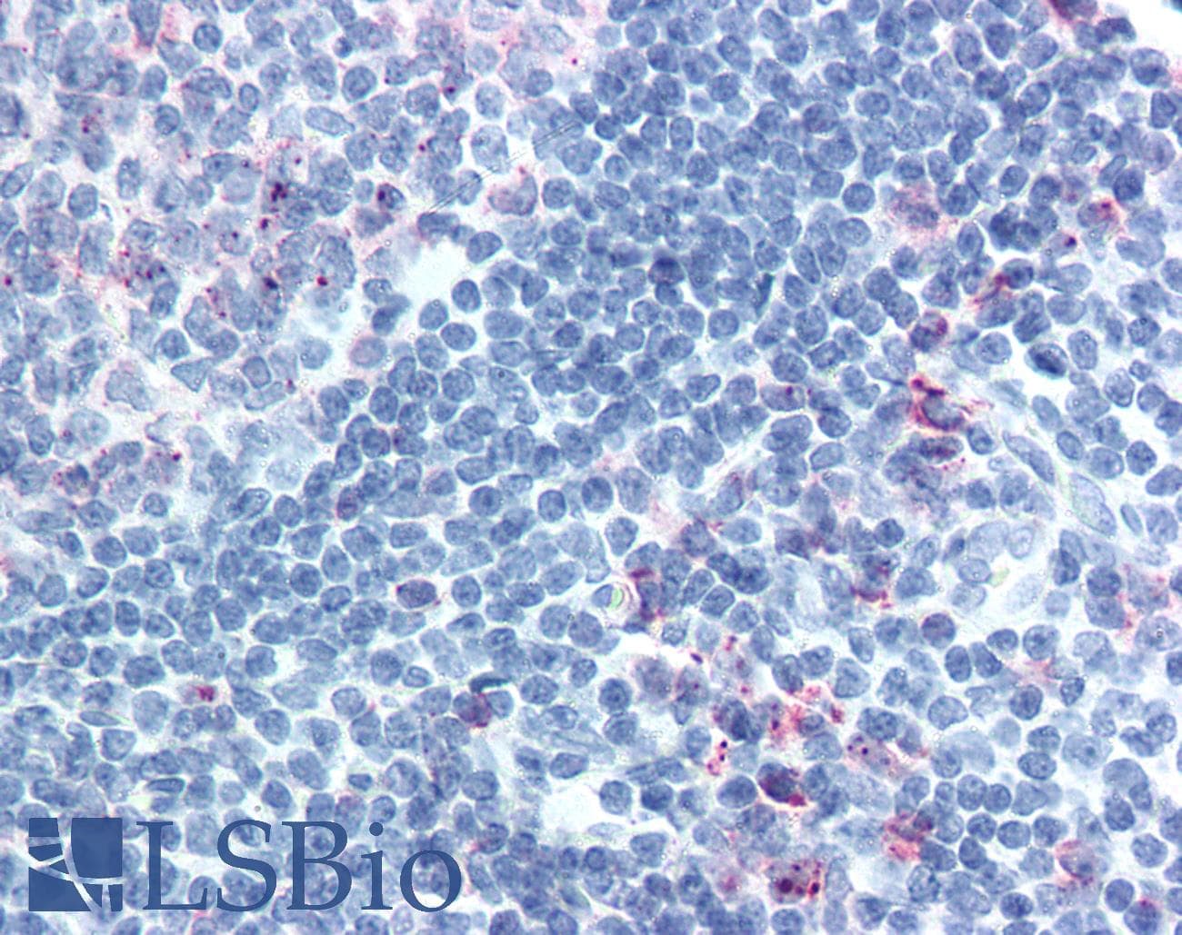 IHC-plus™ CELSR1 Antibody (Extracellular Domain)