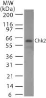 IHC-plus™ CHEK2 / CHK2 Antibody (clone 73C175.1.1)