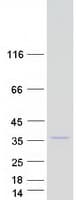 Human COQ3 Protein (Recombinant Myc-DDK (Flag))