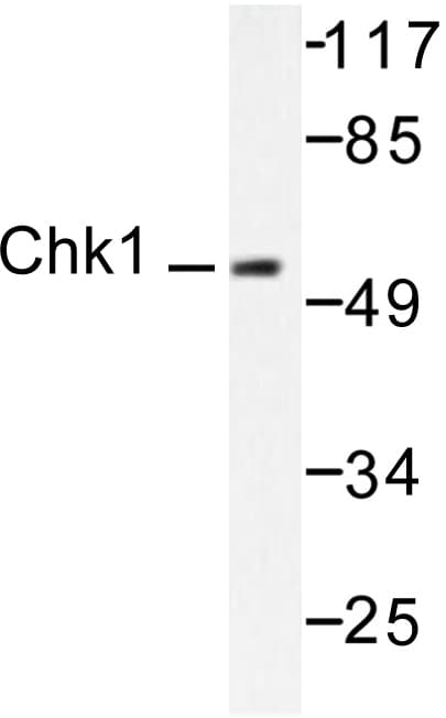 CHEK1 / CHK1 Antibody (Val339)