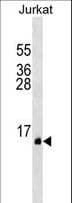 Polyclonal Rabbit anti-Human PATE Antibody (aa87-114, WB)