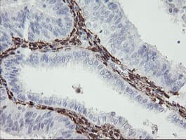 F13A1 / Factor XIIIa Antibody (clone 1H2, Carrier-free)
