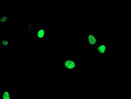 LHX1 Antibody (clone OTI2A4)