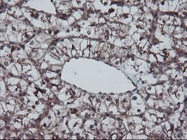 Monoclonal Mouse anti-Human SKIL / SNO / SnoN Antibody (clone OTI3E2, IHC, WB)