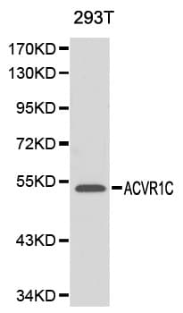 IHC-plus™ ACVR1C / ALK7 Antibody