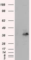 PLEK / Pleckstrin Antibody (clone OTI6H8)