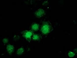 PNMT Antibody (clone OTI2A3)
