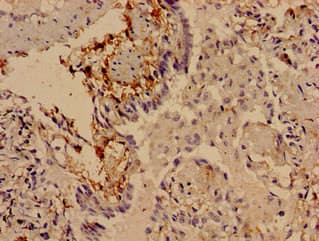 Polyclonal Rabbit anti-Human SLITRK5 Antibody (IHC, IF, WB)