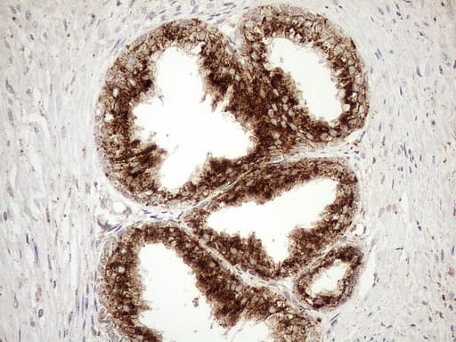 Monoclonal Mouse anti-Human KCTD9 Antibody (clone OTI2G8, aa1-223, IHC, WB)