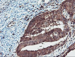 SERPINB1 Antibody (clone OTI3B4)