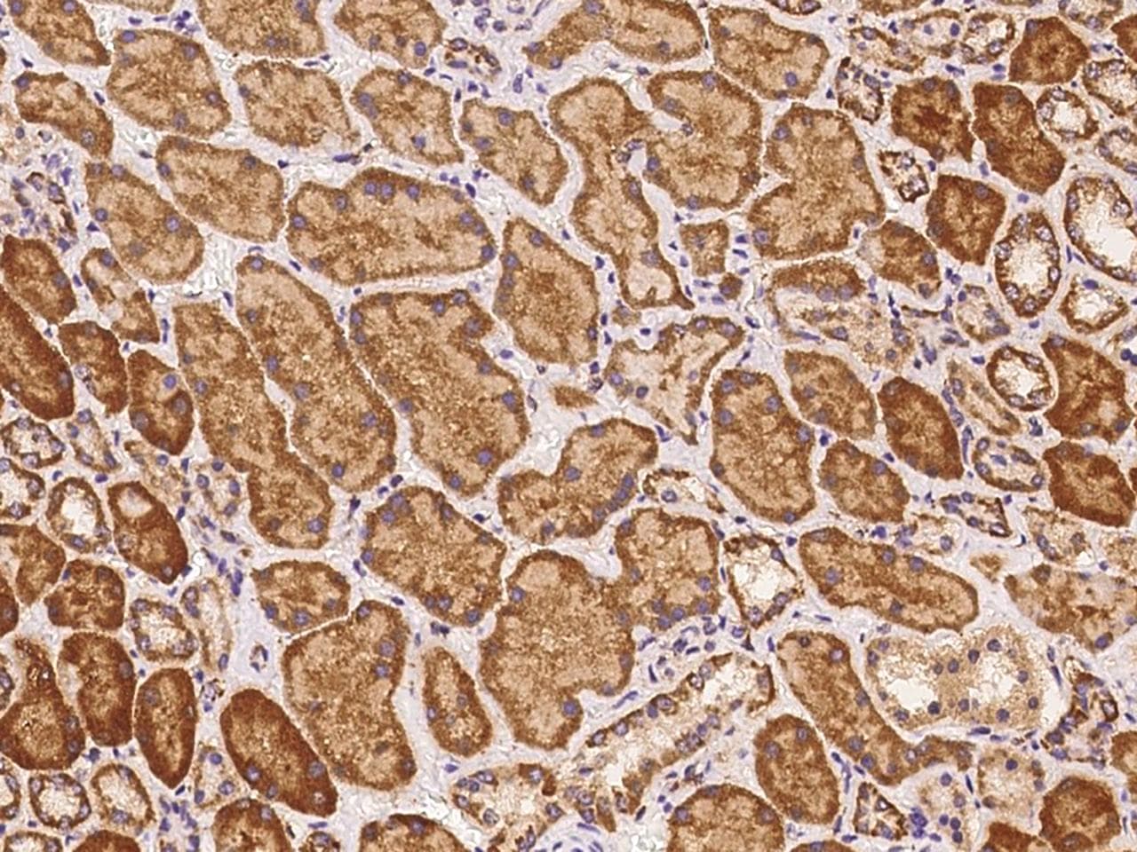 Polyclonal Rabbit anti-Human AADACL4 Antibody (IHC)