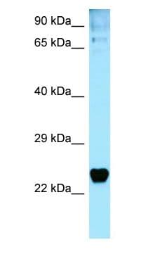 Polyclonal Rabbit anti-Human TP53I3 / PIG3 Antibody (aa163-212, WB)